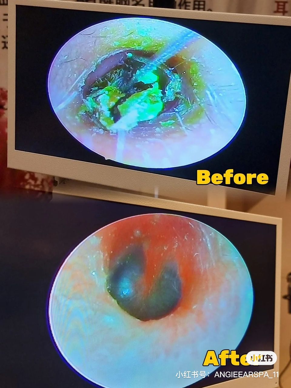 Before and after ear inspection screen